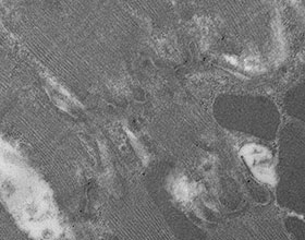 Marquage Claudine 5 sur disques intercalaires de cardiomyocytes - C. Guilbeau-Frugier - I2MC équipe 8 Marquage Claudine 5 sur disques intercalaires de cardiomyocytes - C. Guilbeau-Frugier - I2MC équipe 8